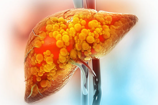 Dieta para el hígado graso: ¿Qué alimentos ayudan a prevenir y revertir el hígado graso?